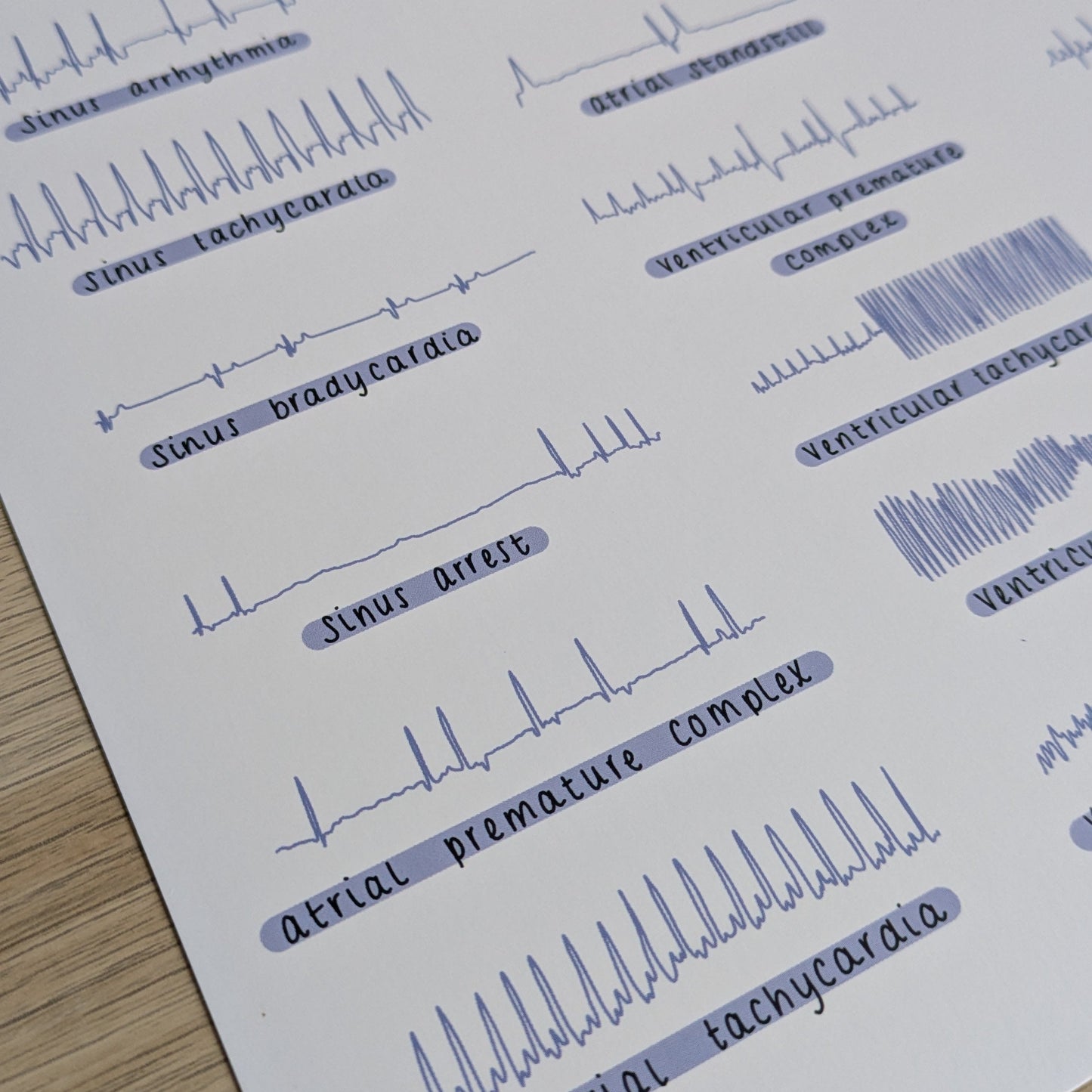 ECG Veterinary Anaesthesia A4 Poster